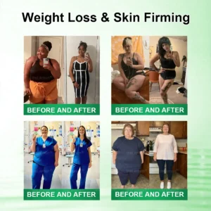 𝐅𝐃𝐀 𝐑𝐞𝐠𝐢𝐬𝐭𝐞𝐫𝐞𝐝 & 𝐆𝐌𝐏 𝐂𝐞𝐫𝐭𝐢𝐟𝐢𝐞𝐝 🌱|𝐈𝐧𝐬𝐋𝐞𝐦𝐨𝐧® 𝗠𝗼𝗿𝗶𝗻𝗴𝗮 × 𝗕𝗲𝗿𝗯𝗲𝗿𝗶𝗻𝗲 × 𝗔𝗠𝗣𝗞 𝟭𝟬-𝗶𝗻-𝟭 𝗠𝗲𝘁𝗮𝗯𝗼𝗹𝗶𝗰 𝗦𝘂𝗽𝗽𝗼𝗿𝘁 𝗡𝗮𝗻𝗼 𝗠𝗶𝗰𝗿𝗼𝗻𝗲𝗲𝗱𝗹𝗲 𝗣𝗮𝘁𝗰𝗵🇺🇸(𝐉𝐮𝐬𝐭 𝐨𝐧𝐜𝐞 𝐚 𝐝𝐚𝐲, 𝐯𝐢𝐬𝐢𝐛𝐥𝐞 𝐜𝐡𝐚𝐧𝐠𝐞𝐬 𝐢𝐧 𝟕 𝐝𝐚𝐲𝐬） ✅ 𝐅𝐨𝐫 𝐨𝐛𝐞𝐬𝐢𝐭𝐲, 🅛🅞🅞🅢🅔 🅢🅚🅘🅝,𝐝𝐢𝐚𝐛𝐞𝐭𝐞𝐬, 𝐬𝐥𝐞𝐞𝐩 𝐚𝐩𝐧𝐞𝐚, 𝐣𝐨𝐢𝐧𝐭 𝐢𝐬𝐬𝐮𝐞𝐬, 𝐚𝐧𝐝 𝐦𝐨𝐫𝐞